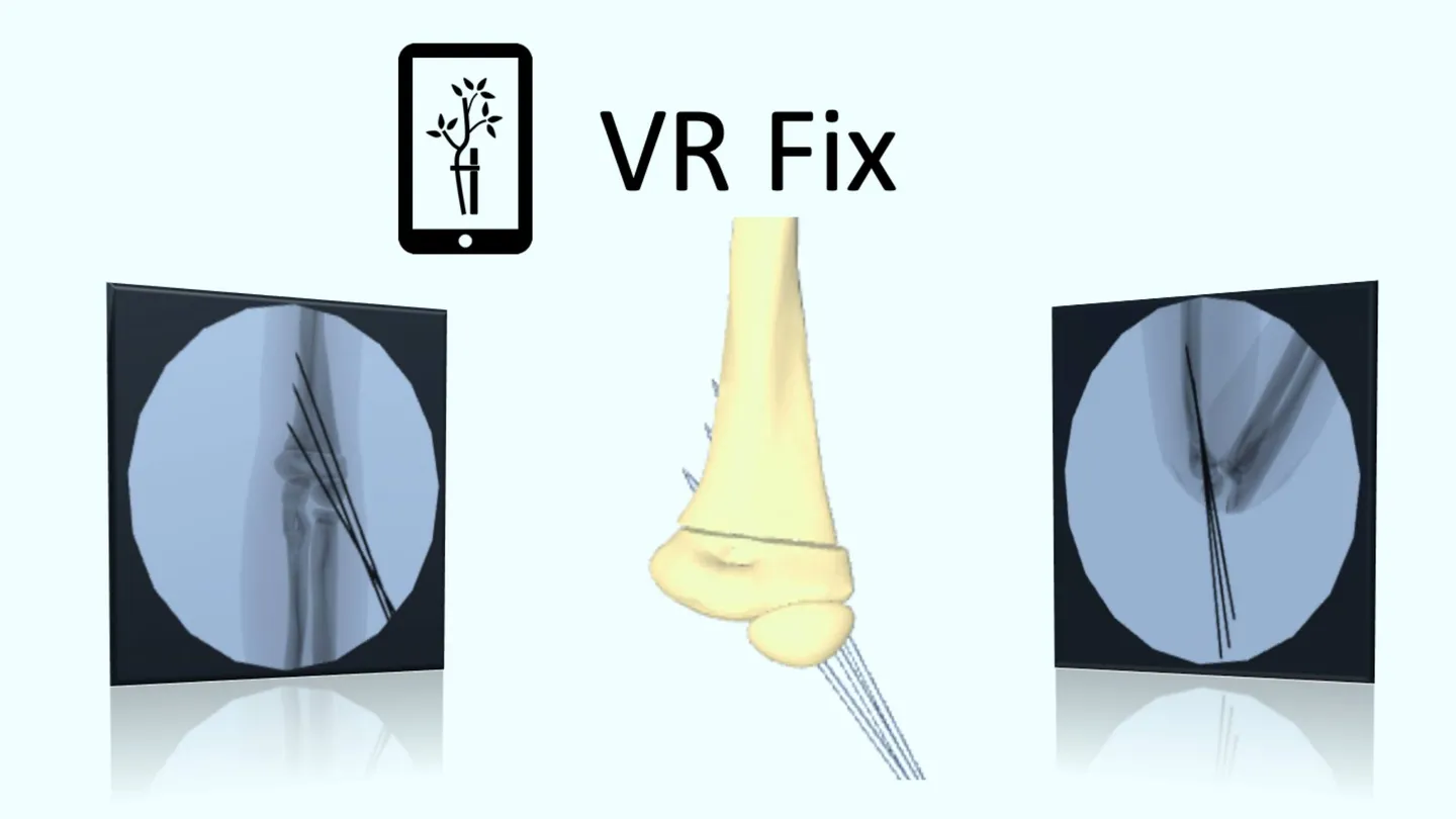 X射线模拟 - VR Fix Supra