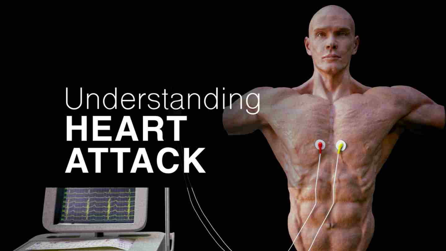 了解心脏病 - Understanding Heart Attack VR游戏封面